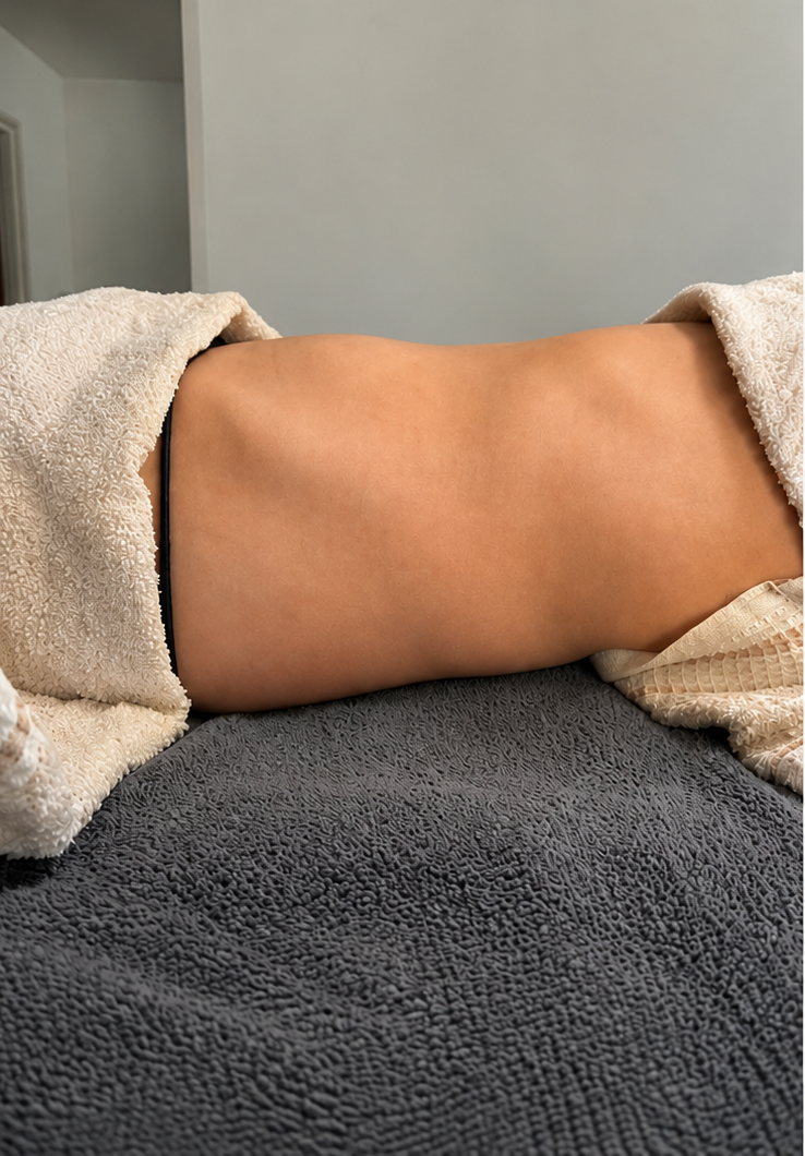Brasilianische Lymphdrainage Vorher bei NOVA Beauty Heidenheim